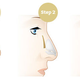 Illustration for article titled Nose Reshaping/Rhinoplasty em/em